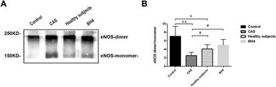 Circulating microparticles are associated with plaque burden and cause eNOS uncoupling in patients with carotid atherosclerosis